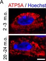 Mouse IgG (H+L) Highly Cross-Adsorbed Secondary Antibody in Immunohistochemistry (IHC)