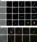 Rabbit IgG (H+L) Highly Cross-Adsorbed Secondary Antibody in Immunocytochemistry (ICC/IF)