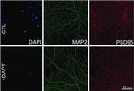 Mouse IgG (H+L) Highly Cross-Adsorbed Secondary Antibody in Immunocytochemistry (ICC/IF)