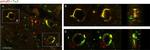 Mouse IgG1 Cross-Adsorbed Secondary Antibody in Immunohistochemistry (IHC)