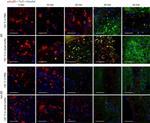 Mouse IgG1 Cross-Adsorbed Secondary Antibody in Immunohistochemistry (IHC)