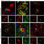 Mouse IgG1 Cross-Adsorbed Secondary Antibody in Immunohistochemistry (IHC)