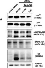 Mouse IgG (H+L) Secondary Antibody in Western Blot (WB)