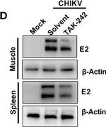 Rabbit IgG (H+L) Secondary Antibody in Western Blot (WB)