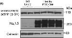 Rabbit IgG (H+L) Secondary Antibody in Western Blot (WB)