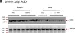 Rabbit IgG (H+L) Secondary Antibody in Western Blot (WB)