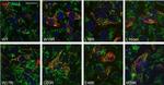 Rabbit IgG (H+L) Highly Cross-Adsorbed Secondary Antibody in Immunocytochemistry (ICC/IF)