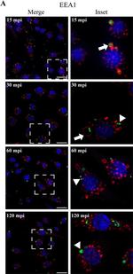 Rabbit IgG (H+L) Cross-Adsorbed Secondary Antibody in Immunocytochemistry (ICC/IF)