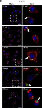 Rabbit IgG (H+L) Cross-Adsorbed Secondary Antibody in Immunocytochemistry (ICC/IF)