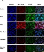 Rabbit IgG (H+L) Cross-Adsorbed Secondary Antibody in Immunocytochemistry (ICC/IF)