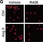 Rabbit IgG (H+L) Highly Cross-Adsorbed Secondary Antibody in Immunohistochemistry (IHC)