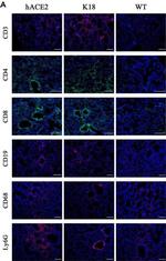 Rabbit IgG (H+L) Highly Cross-Adsorbed Secondary Antibody in Immunohistochemistry (IHC)