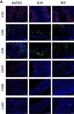 Rabbit IgG (H+L) Highly Cross-Adsorbed Secondary Antibody in Immunohistochemistry (IHC)