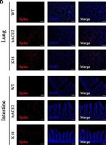 Rabbit IgG (H+L) Highly Cross-Adsorbed Secondary Antibody in Immunohistochemistry (IHC)