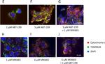 Rabbit IgG (H+L) Cross-Adsorbed Secondary Antibody in Immunocytochemistry (ICC/IF)