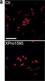 Rabbit IgG (H+L) Highly Cross-Adsorbed Secondary Antibody in Immunocytochemistry (ICC/IF)