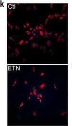 Rabbit IgG (H+L) Highly Cross-Adsorbed Secondary Antibody in Immunohistochemistry (IHC)