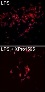 Rabbit IgG (H+L) Highly Cross-Adsorbed Secondary Antibody in Immunocytochemistry (ICC/IF)