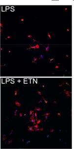 Rabbit IgG (H+L) Highly Cross-Adsorbed Secondary Antibody in Immunocytochemistry (ICC/IF)