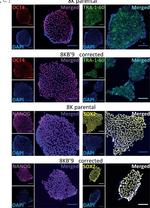 Rabbit IgG (H+L) Highly Cross-Adsorbed Secondary Antibody in Immunohistochemistry (IHC)