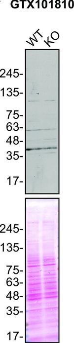 Rabbit IgG (H+L) Secondary Antibody in Western Blot (WB)