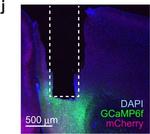 Chicken IgY (H+L) Secondary Antibody in Immunohistochemistry (IHC)