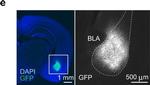 Chicken IgY (H+L) Secondary Antibody in Immunohistochemistry (IHC)