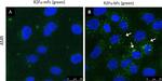 Human IgG (H+L) Cross-Adsorbed Secondary Antibody in Immunocytochemistry (ICC/IF)