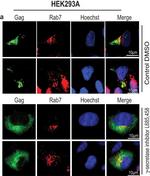 Rabbit IgG (H+L) Highly Cross-Adsorbed Secondary Antibody in Immunocytochemistry (ICC/IF)