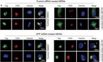 Rabbit IgG (H+L) Highly Cross-Adsorbed Secondary Antibody in Immunocytochemistry (ICC/IF)