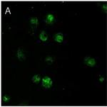 Mouse IgG (H+L) Secondary Antibody in Immunocytochemistry (ICC/IF)