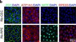 Rabbit IgG (H+L) Highly Cross-Adsorbed Secondary Antibody in Immunocytochemistry (ICC/IF)