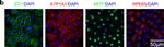 Rabbit IgG (H+L) Highly Cross-Adsorbed Secondary Antibody in Immunocytochemistry (ICC/IF)