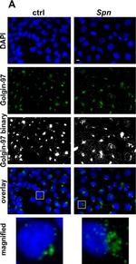 Mouse IgG (H+L) Cross-Adsorbed Secondary Antibody in Immunocytochemistry (ICC/IF)