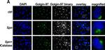 Mouse IgG (H+L) Cross-Adsorbed Secondary Antibody in Immunocytochemistry (ICC/IF)