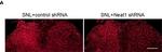 Rabbit IgG (H+L) Highly Cross-Adsorbed Secondary Antibody in Immunohistochemistry (IHC)