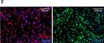 Mouse IgG (H+L) Highly Cross-Adsorbed Secondary Antibody in Immunocytochemistry (ICC/IF)