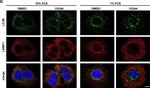 Rat IgG (H+L) Cross-Adsorbed Secondary Antibody in Immunocytochemistry (ICC/IF)