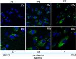 Rabbit IgG (H+L) Highly Cross-Adsorbed Secondary Antibody in Immunocytochemistry (ICC/IF)