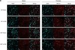 Rabbit IgG (H+L) Highly Cross-Adsorbed Secondary Antibody in Immunohistochemistry (IHC)