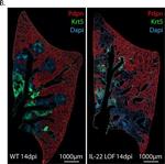 Syrian Hamster IgG (H+L) Cross-Adsorbed Secondary Antibody in Immunocytochemistry (ICC/IF)