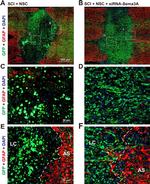 Rabbit IgG (H+L) Highly Cross-Adsorbed Secondary Antibody in Immunohistochemistry (Paraffin) (IHC (P))