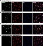 Rabbit IgG (H+L) Highly Cross-Adsorbed Secondary Antibody in Immunocytochemistry (ICC/IF)