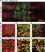 Rabbit IgG (H+L) Highly Cross-Adsorbed Secondary Antibody in Immunohistochemistry (Paraffin) (IHC (P))