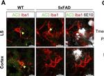 Rabbit IgG (H+L) Highly Cross-Adsorbed Secondary Antibody in Immunocytochemistry (ICC/IF)