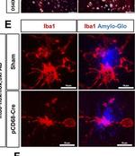 Goat IgG (H+L) Cross-Adsorbed Secondary Antibody in Immunohistochemistry (IHC)