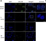 Rabbit IgG (H+L) Highly Cross-Adsorbed Secondary Antibody in Immunocytochemistry (ICC/IF)