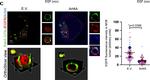 Rabbit IgG (H+L) Cross-Adsorbed Secondary Antibody in Immunocytochemistry (ICC/IF)