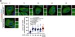 Mouse IgG (H+L) Highly Cross-Adsorbed Secondary Antibody in Immunocytochemistry (ICC/IF)