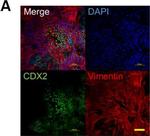 Rabbit IgG (H+L) Cross-Adsorbed Secondary Antibody in Immunocytochemistry (ICC/IF)